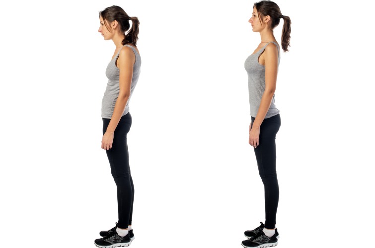 An image of a woman with poor posture next to another image of the same woman with correct posture.