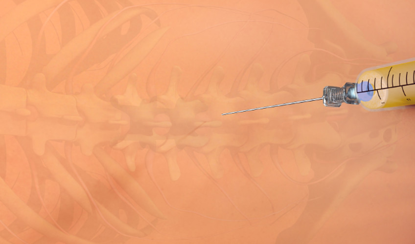 Image of a needle going into a person’s back, with an illustration of the spine in the background, to show lumbar epidural steroid injections.