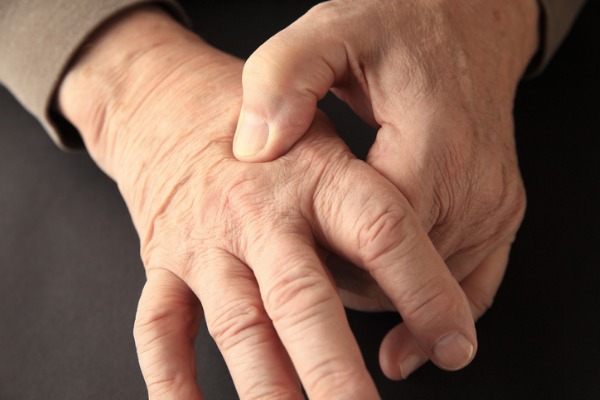 A man's hands are in pain because of peripheral neuropathy.