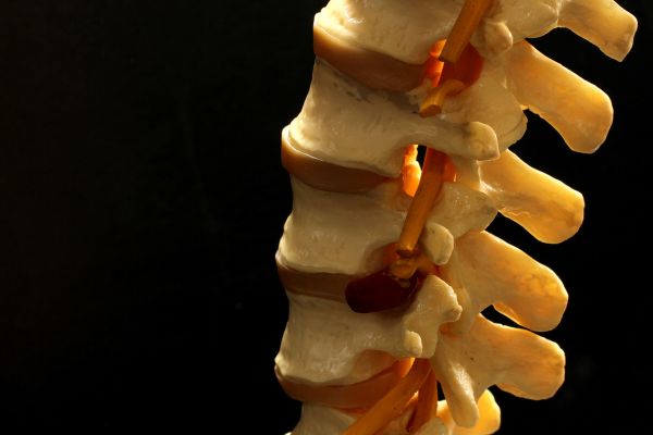 Vertebrae along the spine