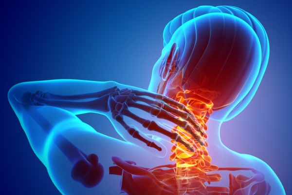 A graphic showing an X-ray of the spine, with the cervical area highlighted to show neck pain. 